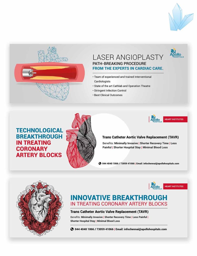 Heart Angioplasty and Heart coronary artery blocks